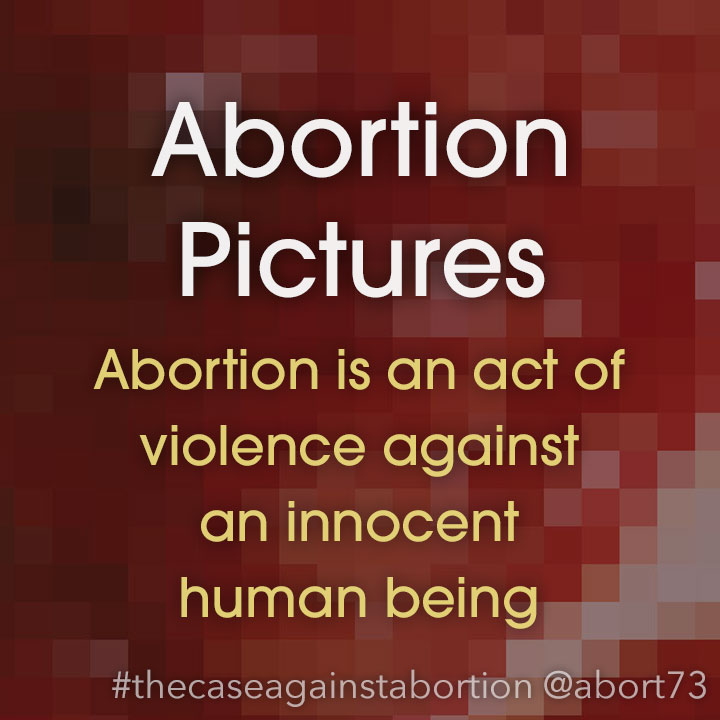 Abortion The Deliberate Termination Of A Human
