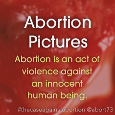 Abortion Pictures