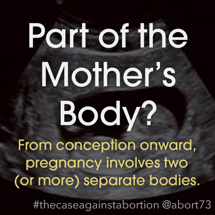 Part of the Mother’s Body?: From conception onward, pregnancy involves two (or more) separate bodies.
