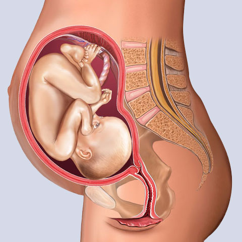 28 week fetus