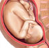32 week fetus