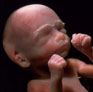 26 week fetus